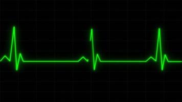 concepto e8 animación de monitor de pulso cardíaco realista con fondo de cuadrícula en la pantalla de electrocardiograma video
