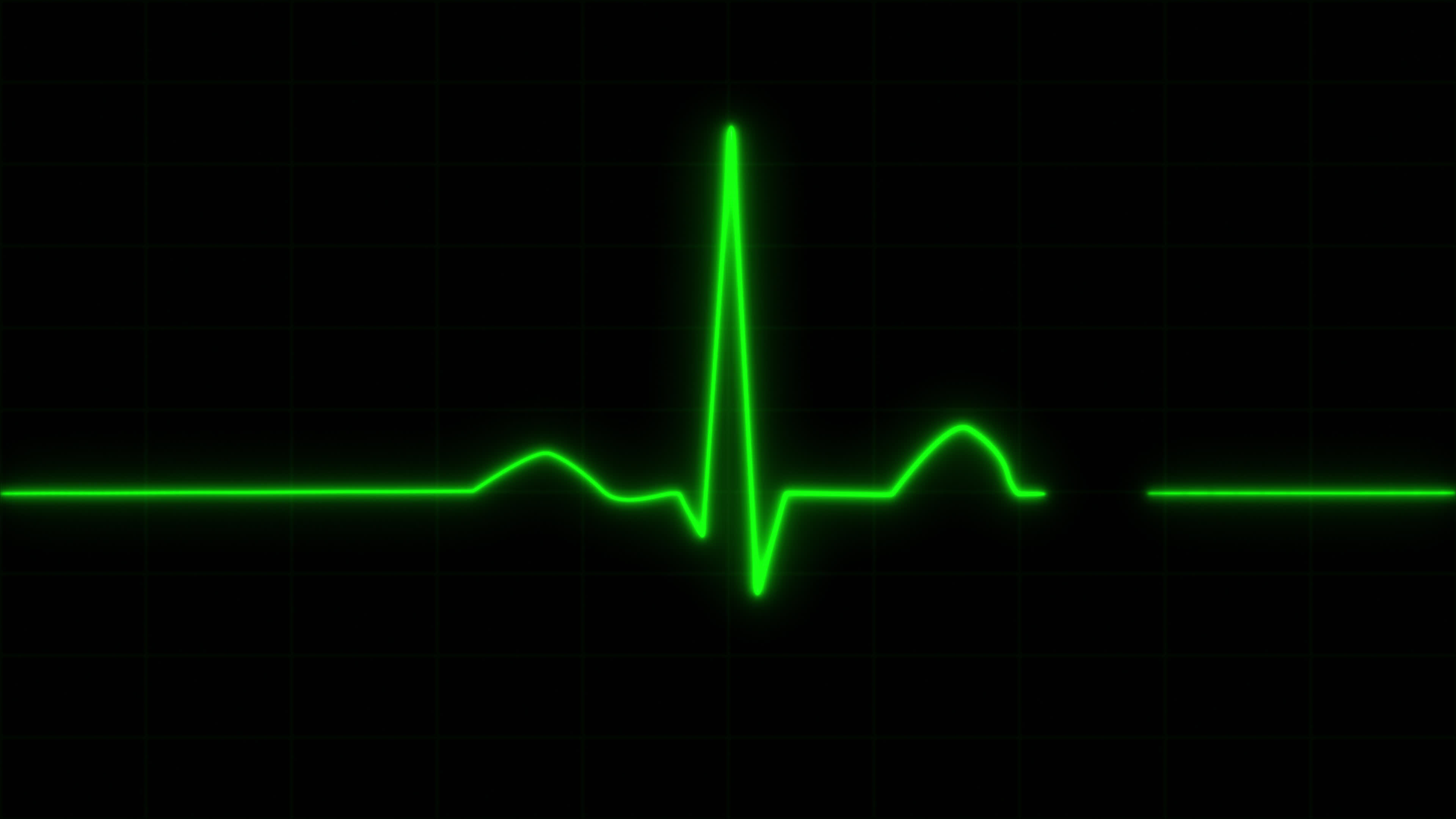 Concept E2 Realistic Heart Pulse Monitor Animation with Grid Background