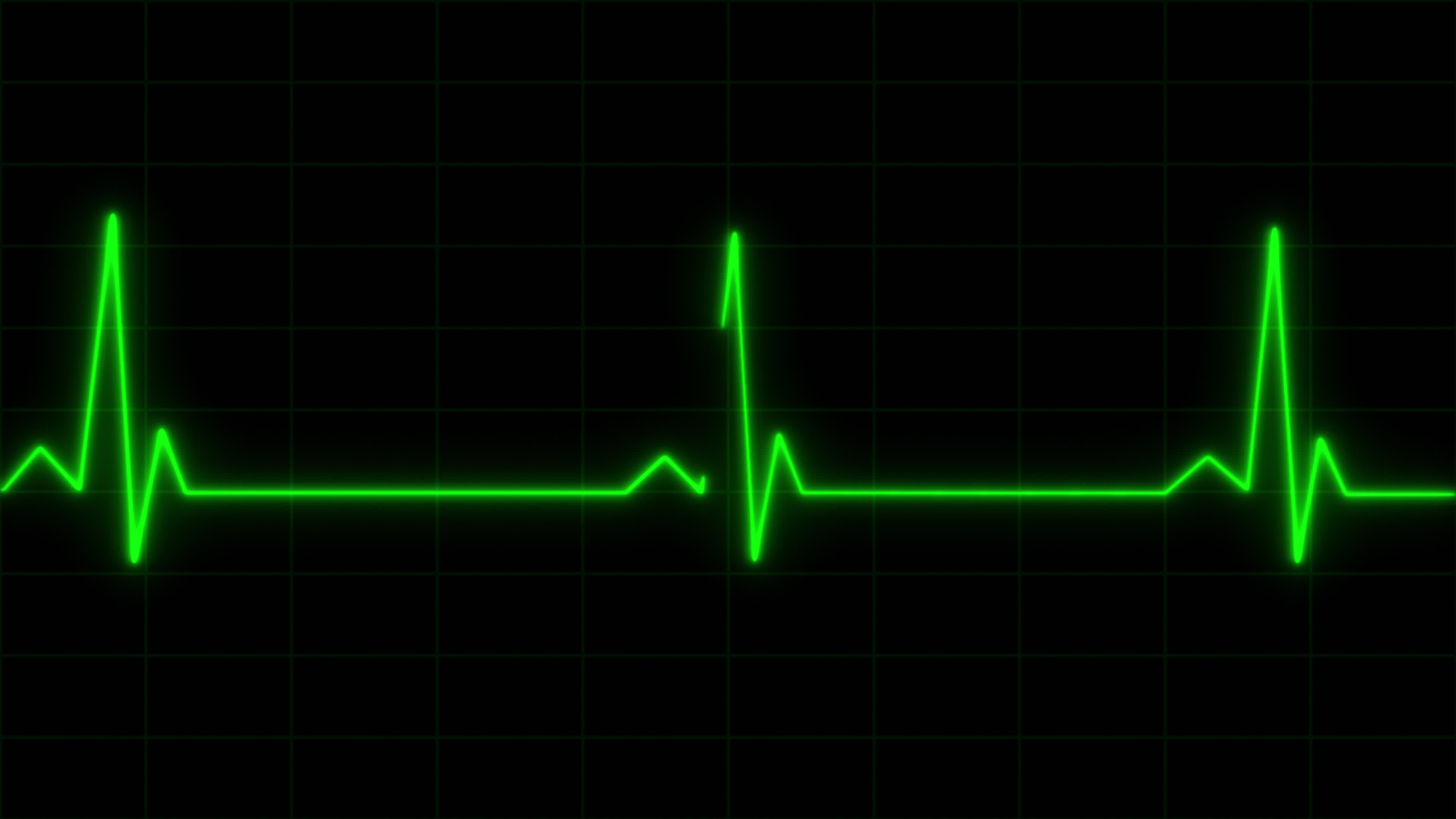 Concept E6 Realistic Heart Pulse Monitor Animation with Grid Background on  Electrocardiogram Screen 10355873 Stock Video at Vecteezy