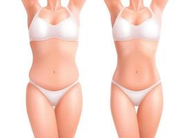 Female Weight Loss Set vector
