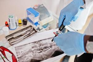 Dentist office and doctor practice concept. Close uo of hands professional african american doctor at dentistry medical pointing on teeth X-ray. photo