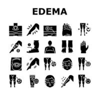 conjunto de iconos de colección de síntomas de enfermedad de edema vector