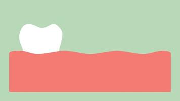 Dientes blancos a amarillos, concepto de higiene y atención de la salud dental - dibujos animados de dientes de estilo plano renderizado en 2d, en formato de video de ultra alta definición 4k y uhd 3840x2160