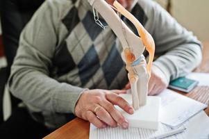 Artificial human knee joint model in medical office on table. photo