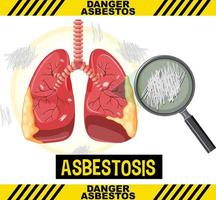 Diagram showing asbestosis in lungs vector