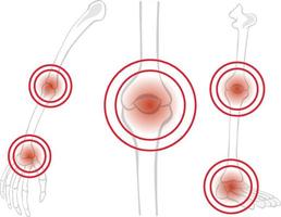 articulación de hueso humano con mancha roja vector