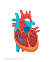 Heart of Defect vector