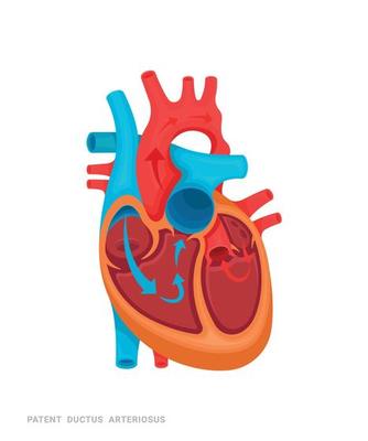 Heart of Defect