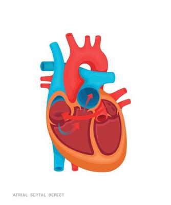 Heart of Defect