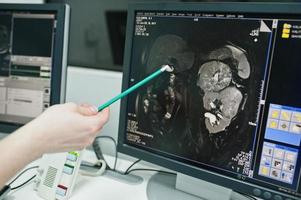 Medical theme. Diagnostic mri center in hospital, monitors of computer with human brain on it. photo