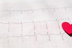 close up of an electrocardiogram in paper form vith red wooden heart. ECG or EKG paper  background texture.  medical and healthcare concept. photo