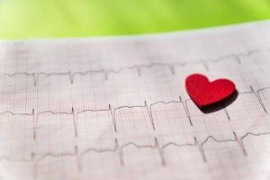 close up of an electrocardiogram in paper form vith red wooden heart. ECG or EKG paper on black  background.  medical and healthcare concept. photo