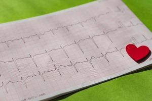 close up of an electrocardiogram in paper form vith red wooden heart. ECG or EKG paper on green  background.  medical and healthcare concept. photo