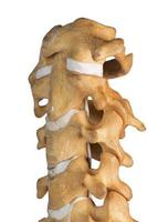 Artificial human cervical spine photo