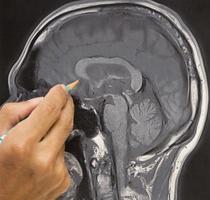 imagen de resonancia magnética del cerebro y la mano del médico foto