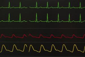 Monitoring displays of patient vital signs photo