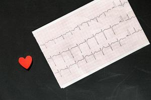 vista superior de un electrocardiograma en papel con corazón de madera roja. papel ecg o ekg sobre fondo negro. concepto médico y sanitario. foto