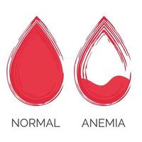 Normal and anemic drop of blood. Lack of red cells, anemia. Isolated on white background. Vector illustration