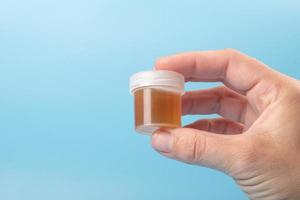 hand with test tube, urinalysis on blue background with copy space photo