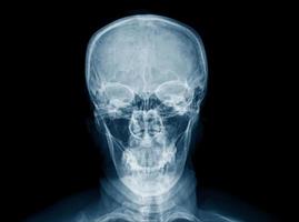 x ray human skull on black photo