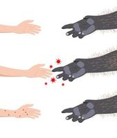 Human hand touching monkey's paw. transmission of the monkeypox virus from apes to humans vector