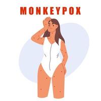 Monkeypox virus.Woman with rash and headache. Skin infections. Monkeypox virus infographic. Isolated vector illustration