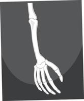 esqueleto de brazo y mano vector