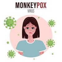 Human infected with monkeypox. Blisters on the skin when infected. Monkeypox virus Symptoms. Vector illustration of sick person. Cartoon character portrait with red rash on face.