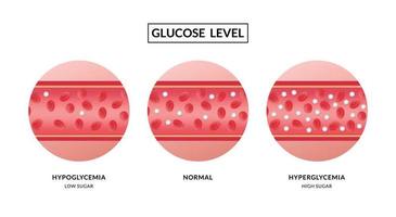 glucosa en el vaso sanguíneo. hipoglucemia e hiperglucemia vector