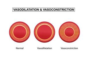 vasodilatación y vasoconstricción. comparación de vasos sanguíneos.