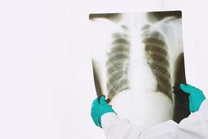 Doctor is examining x-ray film of lungs photo