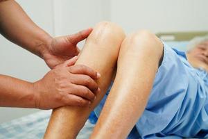médico revisando a una anciana asiática con cirugía de reemplazo de rodilla con cicatriz en el hospital. foto