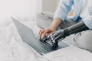 Bionic prosthesis and healthy arm. Hands of disabled girl are typing on keyboard of laptop. photo