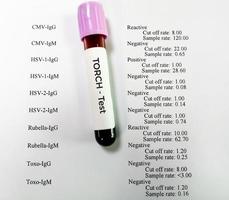 Blood sample isolated on patient report, TORCH panel testing. photo