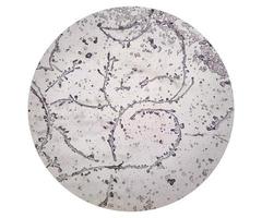 Microscopic image showing Hyphae of dermatophytes,, skin scraping for fungus test photo