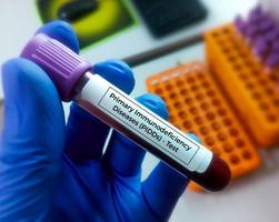 Biochemist hold blood sample for Primary Immunodeficiency or PID test in laboratory. photo