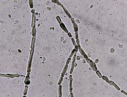 imagen microscópica que muestra hifas de dermatofitos, raspado de piel para prueba de hongos foto