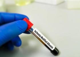 Blood sample for Ischemia modified albumin test, a marker of myocardial ischemia. Percutaneous coronary intervention. photo