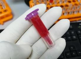 Scientist holding eppendorf with hemolyzed blood sample. Hemolysis sample can cause of false patient report. pre-analytical error. photo