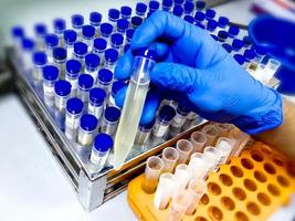 Technician hold urine sample for medical analysis with laboratory background. photo