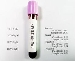 muestra de sangre aislada para la prueba hsv 1 y hsv 2 con informe anormal del paciente. foto