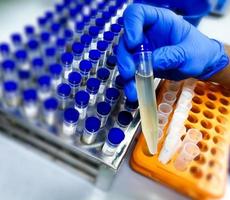 Technician hold urine sample for medical analysis with laboratory background. photo