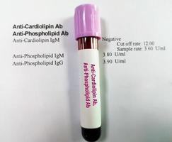 prueba anti-cardiolipina ab y anti-fosfolípido ab, diagnóstico de trastorno autoinmune foto