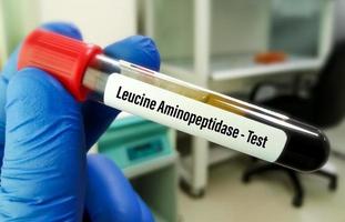 leucina aminopeptidasa o prueba de vueltas mide la cantidad de esta enzima en la sangre para diagnosticar enfermedades hepáticas. foto