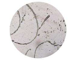 Microscopic image showing Hyphae of dermatophytes,, skin scraping for fungus test photo