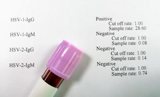 muestra de sangre aislada para la prueba hsv 1 y hsv 2 con informe anormal del paciente. foto