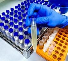 Technician hold urine sample for medical analysis with laboratory background. photo