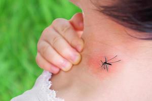 linda niña asiática tiene sarpullido y alergia en la piel del cuello por picadura de mosquito y chupa sangre mientras juega al aire libre foto