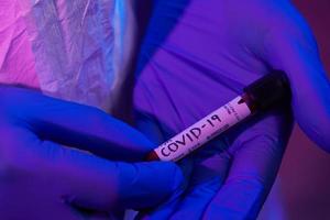 Coronavirus, Doctor holding positive covid-19 virus Blood Sample test tube photo