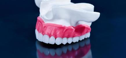 Upper human jaw model with a reflection on the glass photo